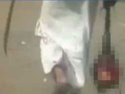 Elinde kesik baş ile teslim oldu