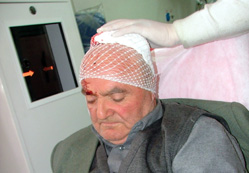 Abdest alırken başına mermer düştü