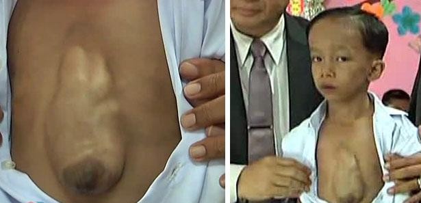 Onun kalbi dışarda atıyor