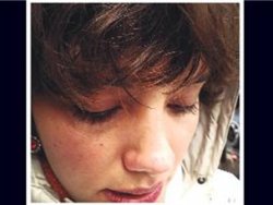 Nehir Erdoğan biber gazı kurbanı