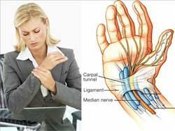 Kadınların korkulu rüyası: Karpal tünel