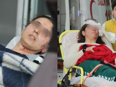 Baldızlarını hastanelik etti