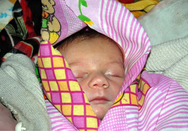 Ağrı'da mucize bebek mutluluğu