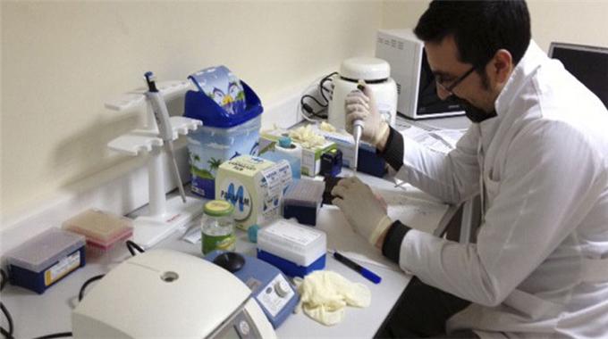 Prostat kanserine idrarla tespit