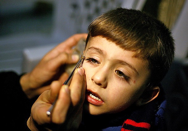 Gazze'de alternatif tıp: Arıyla tedavi