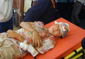 Çakmak gazı dolum tüpü elinde patladı