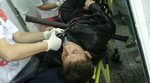 Göğsüne 2 metrelik boru saplandı