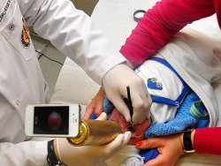 Göz muayeneleri cep telefonunda