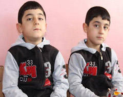 Tek yumurta ikizlerinin ilginç yaşamları