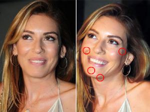 Sinem ilk estetiğini oldu