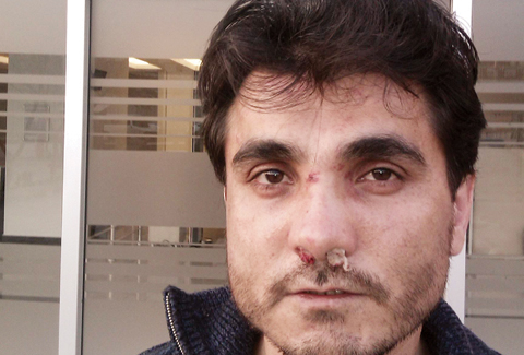 Albay baba polis korumasındaki eşcinsel oğlunu kaçırdı