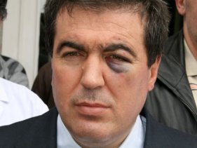 Doktoru darp eden sanığa 6 ay hapis