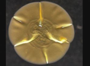 Bakteriler cep telefonunda yaşıyorlar