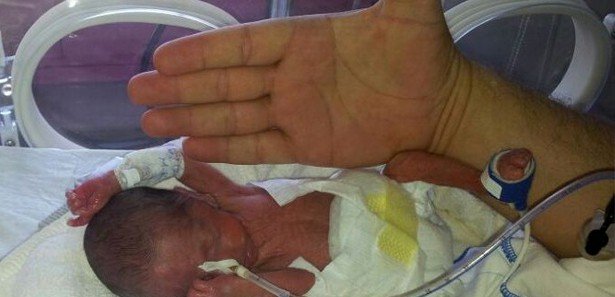 Parmak bebekler hayata tutundu