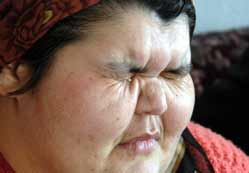 Obez kardeşlere yardım eli uzanacak