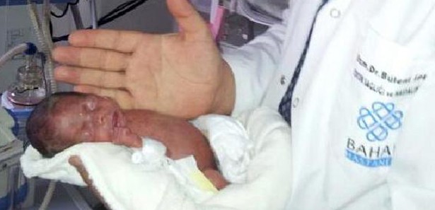 630 gramlık bebek hayata tutundu