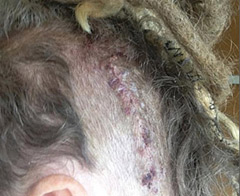 Ünlü şarkıcının beyninden öyle bir şey çıktı ki