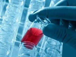 AIDS tedavisinde bir ilk