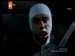 Polat'ın yüzü değişecek mi ? TIKLA İZLE