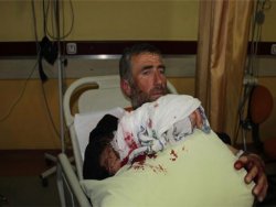 Koyun otlatırken ölümden döndü