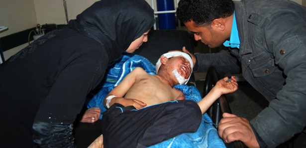 Oyun oynarken bombaların hedefi oldu