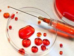 Yeni bir kan grubu ortaya çıktı