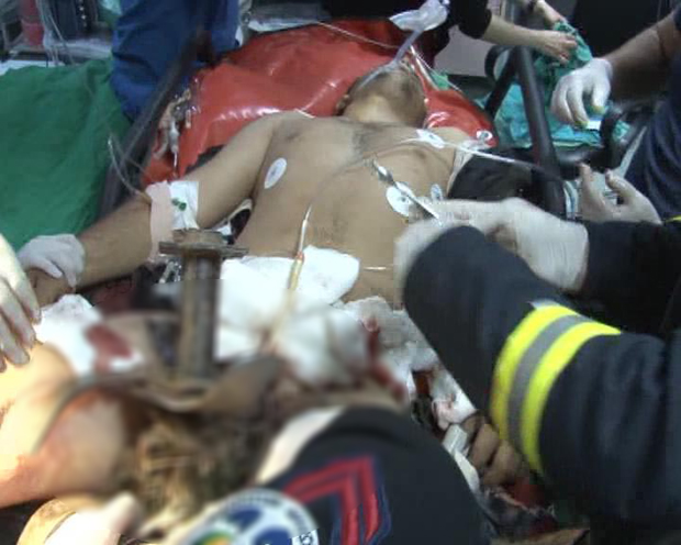 Mersin'de tarihe geçecek ameliyat