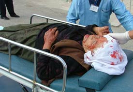 Yaşlı kadın at arabasından düştü