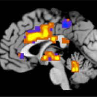Fiziksel acının miktarı, ilk kez objektif olarak ölçüldü