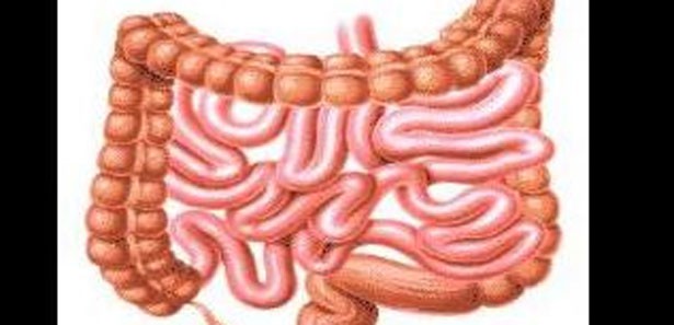 İnce bağırsaktan idrar torbası yapıldı
