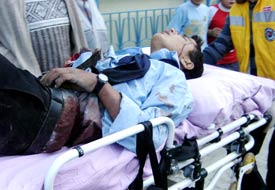 Öğrencilerin kavgası kanlı bitti