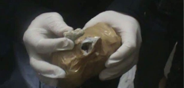 Cinsel organında ve midesinde uyuşturucuçıktı