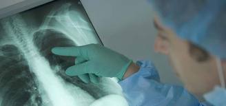 Erken Teşhis Hayat Kurtarırmı ?