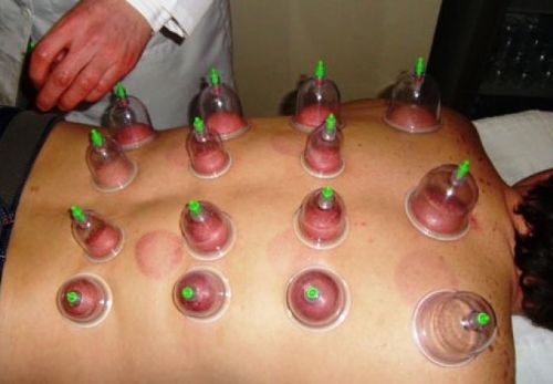 5 bin yıllık tedaviye büyük ilgi