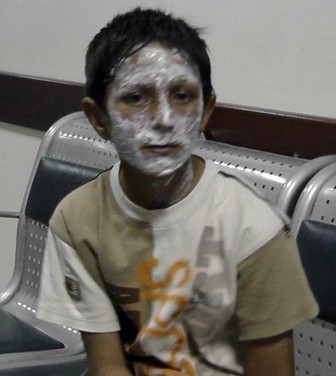 Benzin bidonunu ateşe veren çocuk yüzünü yaktı