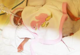 23 haftalık bebeğin yaşam mücadelesi