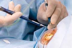 Minik Kızın Korneaları, Görmeyen İki Kişiye Işık Oldu