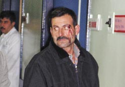 Damattan, kayınpedere dayak