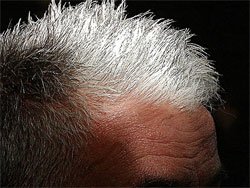 Beyaz saçların tek suçlusu genler değil