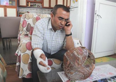 Sigara içmemek için başına tel kafes geçirdi