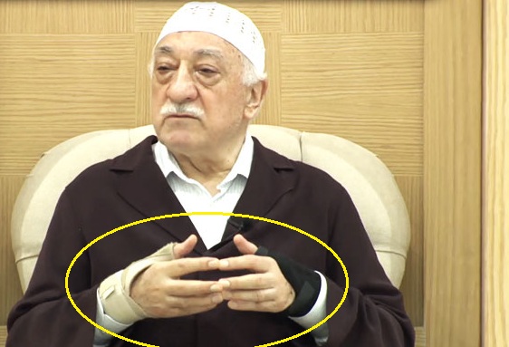 Gülen son konuşmasını iki bileği sargılı olarak yaptı