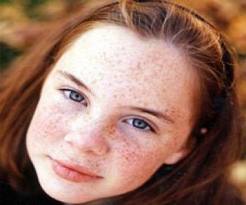 Güneş lekelerinden korunmanın yolları