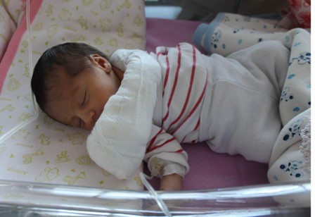 6 günlük bebeğin makasla koparılan parmağı dikildi