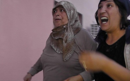 Dilini eşek arısı soktu