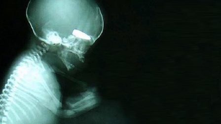 Sigarasına hamile kadınları avlıyorlar