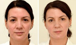 Günde 3 litre suyla bakın ne hale geldi