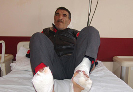 Ayak parmakları dondu