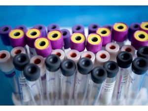 Hepatit B, C Ve D virüsleri sinsi gelişiyor