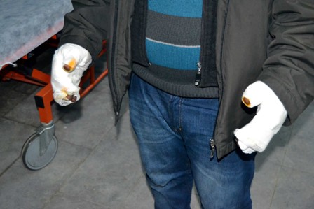 Yanan sobanın borularını düzeltirken ellerini yaktı
