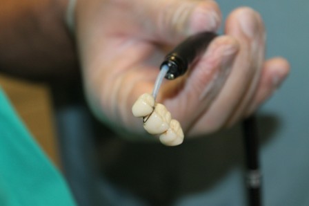 "Yağlı et dişleri daha çabuk çürütüyor"